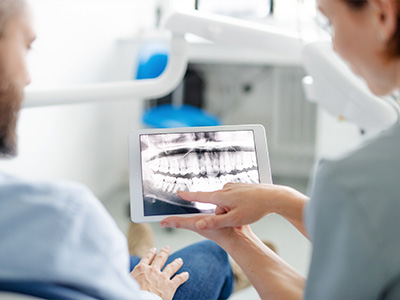 Artistic Family Dental | All-on-4 reg , Dental Bridges and Dental Fillings