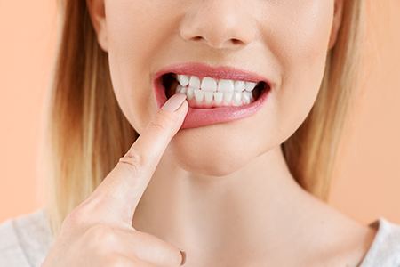 Artistic Family Dental | Dental Bridges, Extractions and Crowns